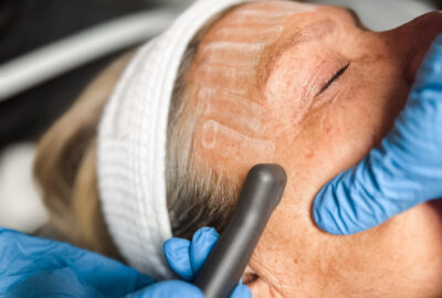 Sea Salt Resurfacing